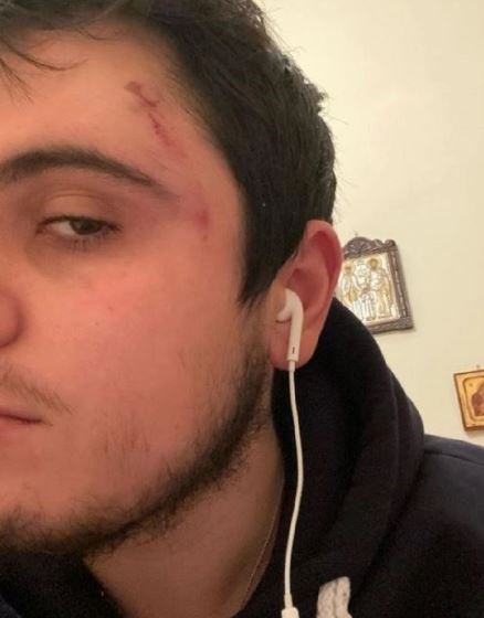 Σοκαριστική μαρτυρία για οπαδική βία στα Χανιά: «Η τύχη με χωρίζει από τον Άλκη» (εικόνες)