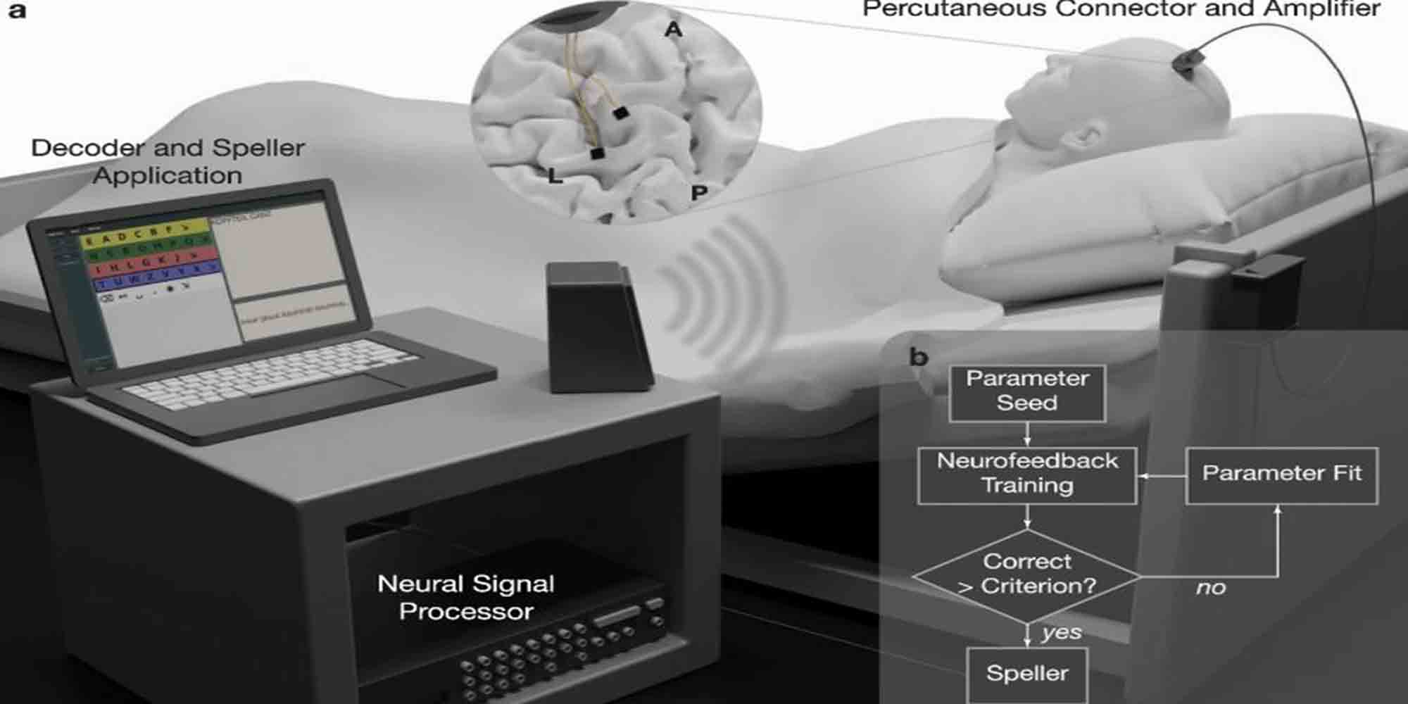 Το σχεδιάγραμμα της συσκευής του εγκεφάλου, όπως το παρουσίασαν οι επιστήμονες