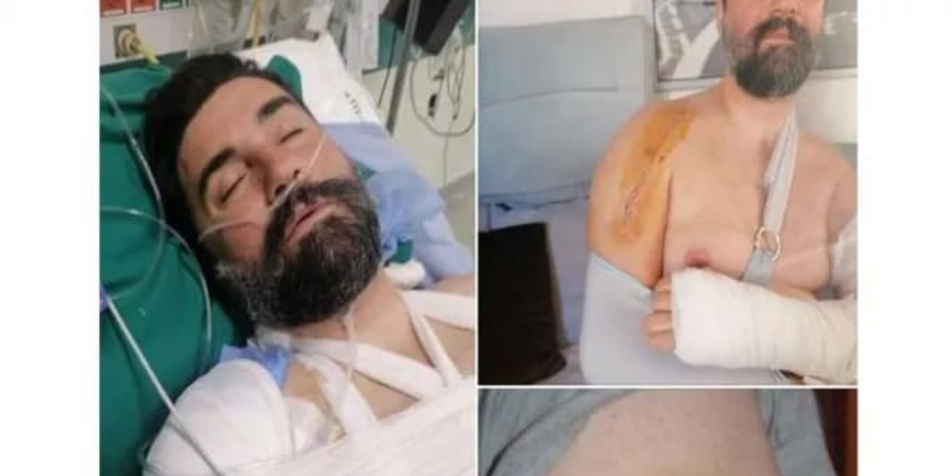 Εικόνες από τα χτυπήματα στον διασώστη