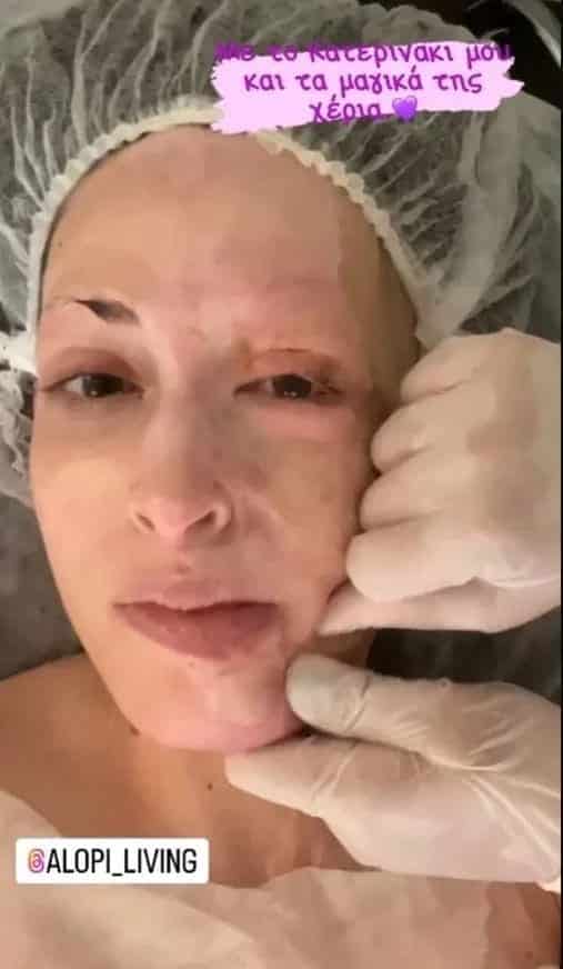 Η Ιωάννα Παλιοσπύρου έδειξε τις θεραπείες που κάνει στο πρόσωπό της