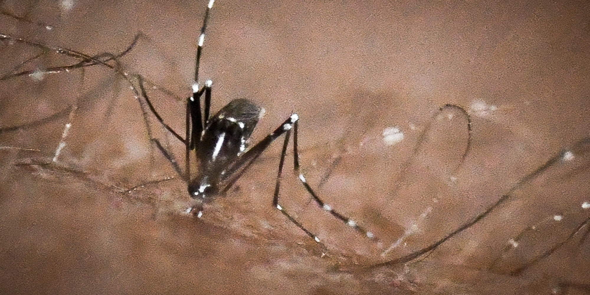 Κουνούπι στην επιδερμίδα ανθρώπου