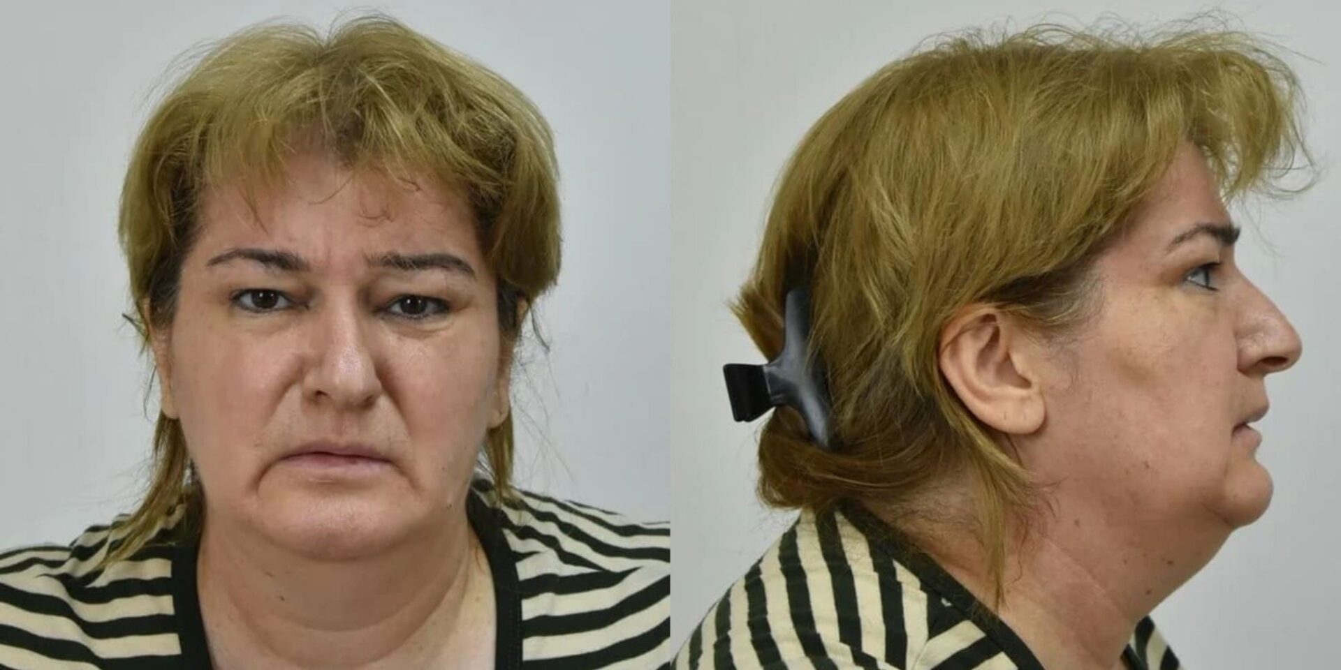 Η «οικιακή βοηθός» που νάρκωνε και λήστευε ηλικιωμένους στην Αττική