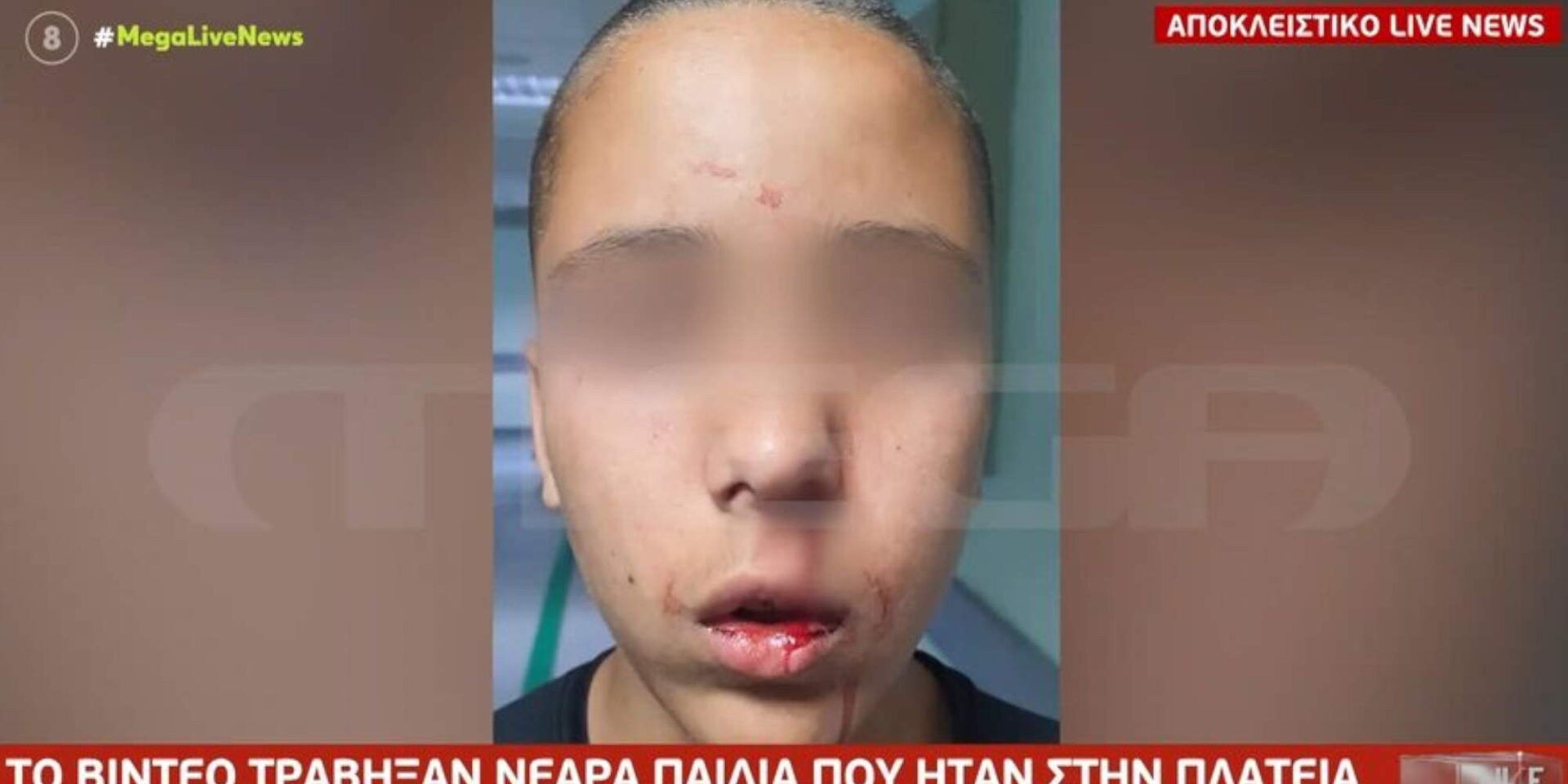 Νεαρός έπεσε θύμα ξυλοδαρμού από συνομηλίκους του