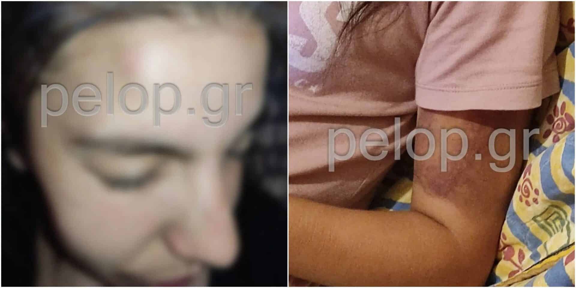 Η 16χρονη από την Πάτρα που έχει πέσει θύμα κακοποίησης από 25χρονο