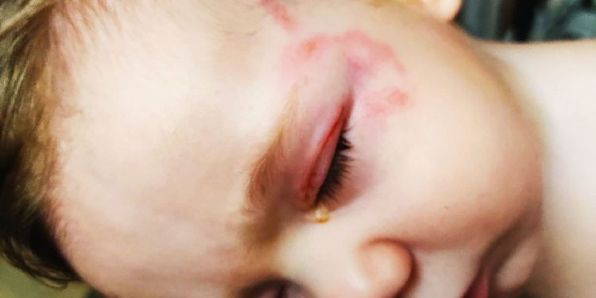 vrefos kriti 5 9 2022 1 - Κρήτη: Συγκλονίζει η μητέρα του 8 μηνών βρέφους που δέχθηκε επίθεση από σκύλο: «Δεν ήξερα εάν είχε μάτι» - Τι λέει η ιδιοκτήτρια (εικόνες & βίντεο)