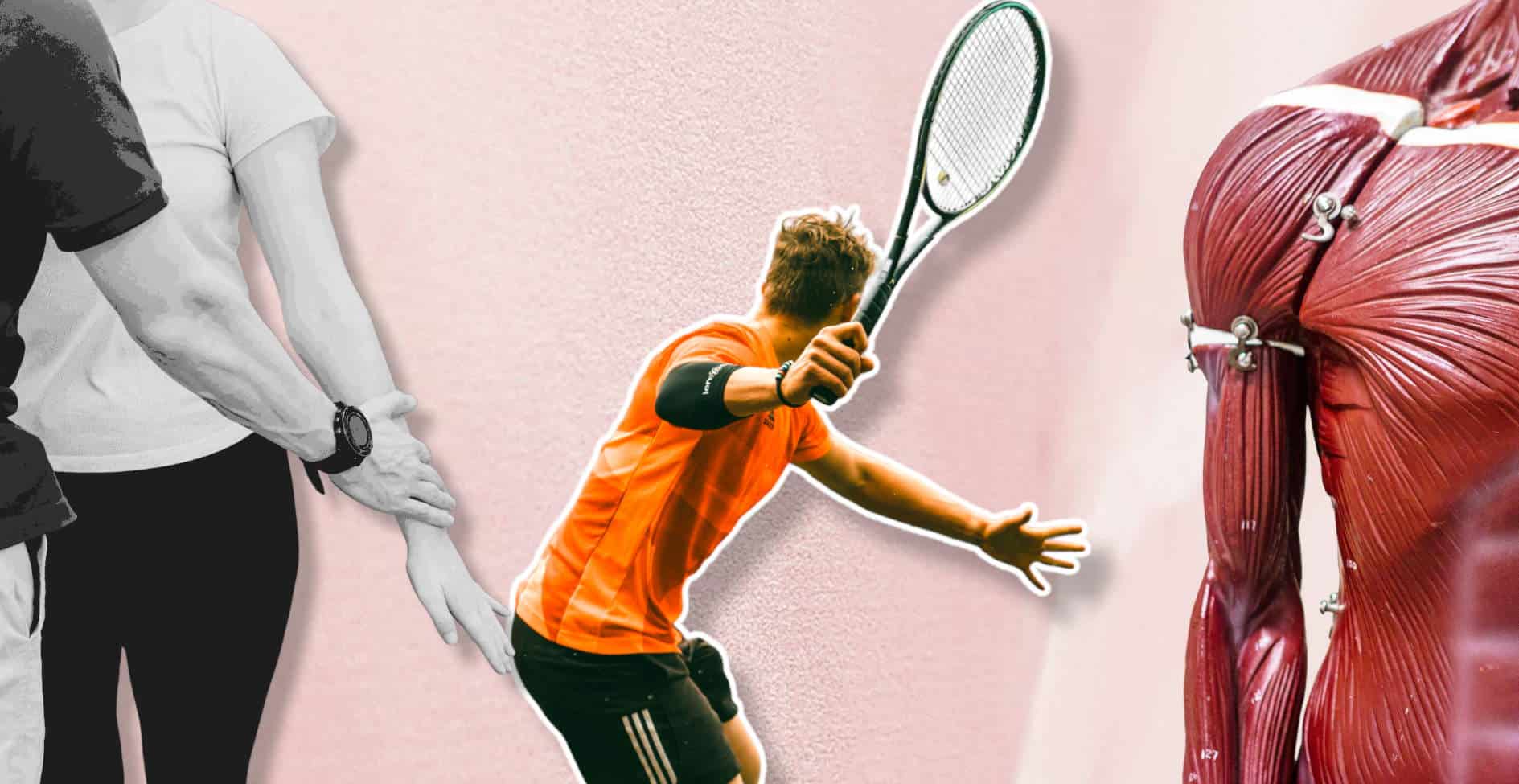 Το σύνδρομο «αγκώνα του τένις»