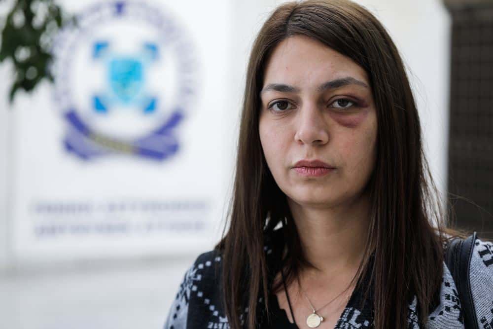 Η Μαρία Απατζίδη με χτύπημα στο πρόσωπο μετά από επίθεση από ΜΑΤ