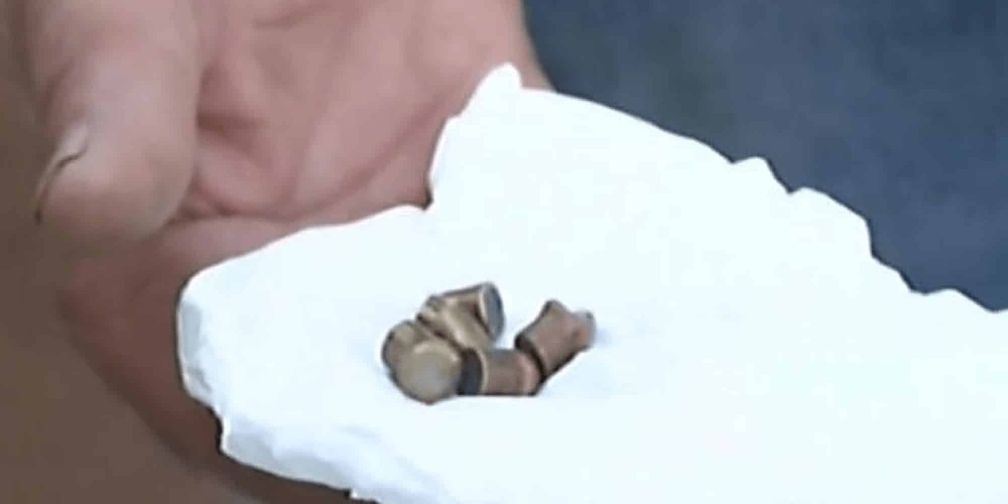 Αδέσποτη σφαίρα τραυμάτισε κάτοικο στα Άνω Λιόσια