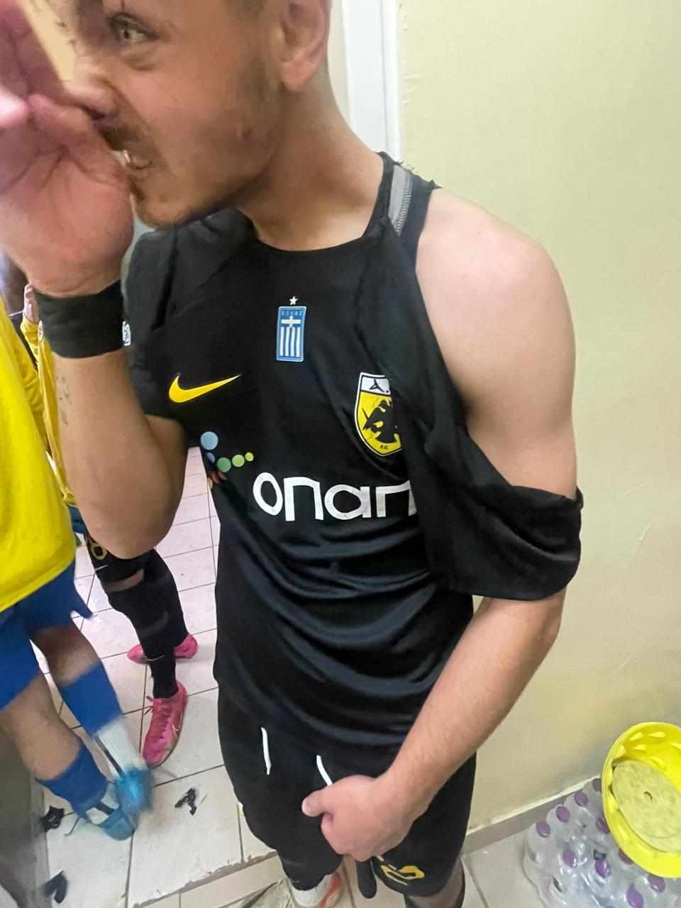 Ποδοσφαιριστής της ΑΕΚ Β' χτυπήθηκε στα επεισόδια στην Κοζάνη